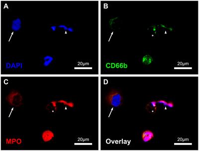 Neutrophil extracellular traps - a potential trigger for the development of thrombocytopenia during extracorporeal membrane oxygenation